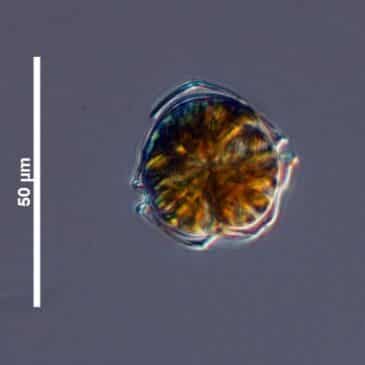Dinoflagellés du genre Alexandrium